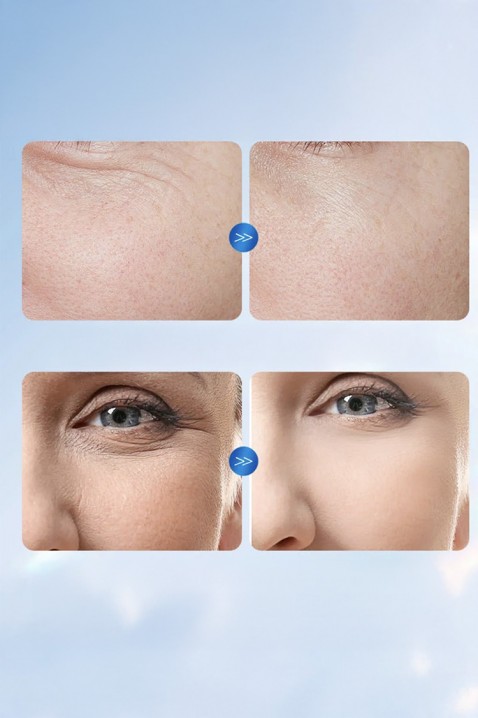 Ampule pentru față SADOER Hyaluronic AcidIVET.RO - Reduceri de până la -80%