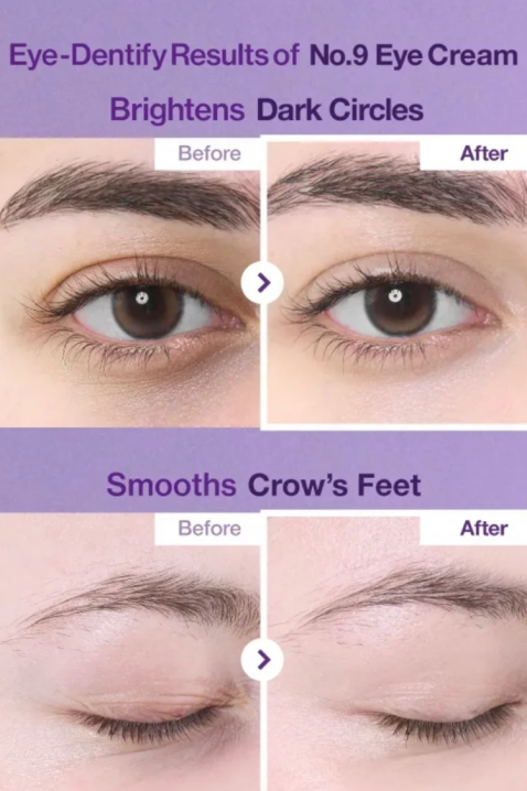 NUMBUZIN No.9 NAD+ Retinol Volumetox Eye Cream, 10 mlIVET.RO - Reduceri de până la -80%