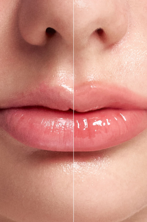 Intense lip plumper with microneedles Reedle Shot Lip Plumper Expert, 4,3 gIVET.RO - Reduceri de până la -80%