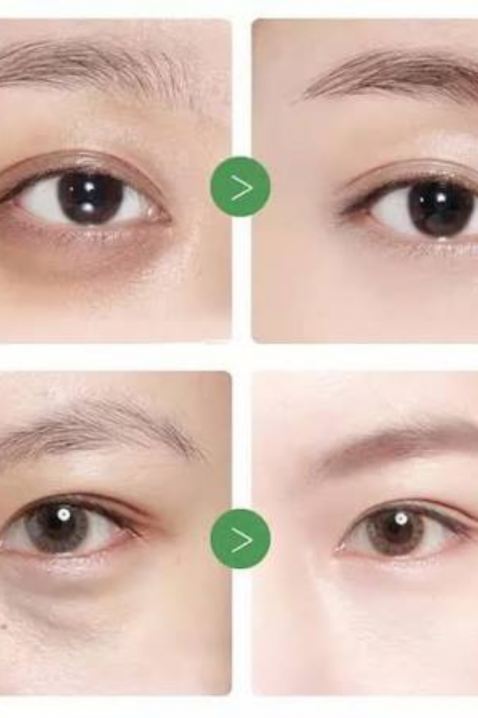 Mary&May Tranexamic Acid + Glutathion Eye Cream, 30 gIVET.RO - Reduceri de până la -80%